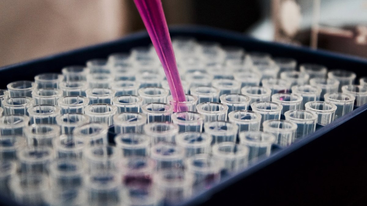 Why Iron Deficiency Suddenly Trended and When You Need a Test