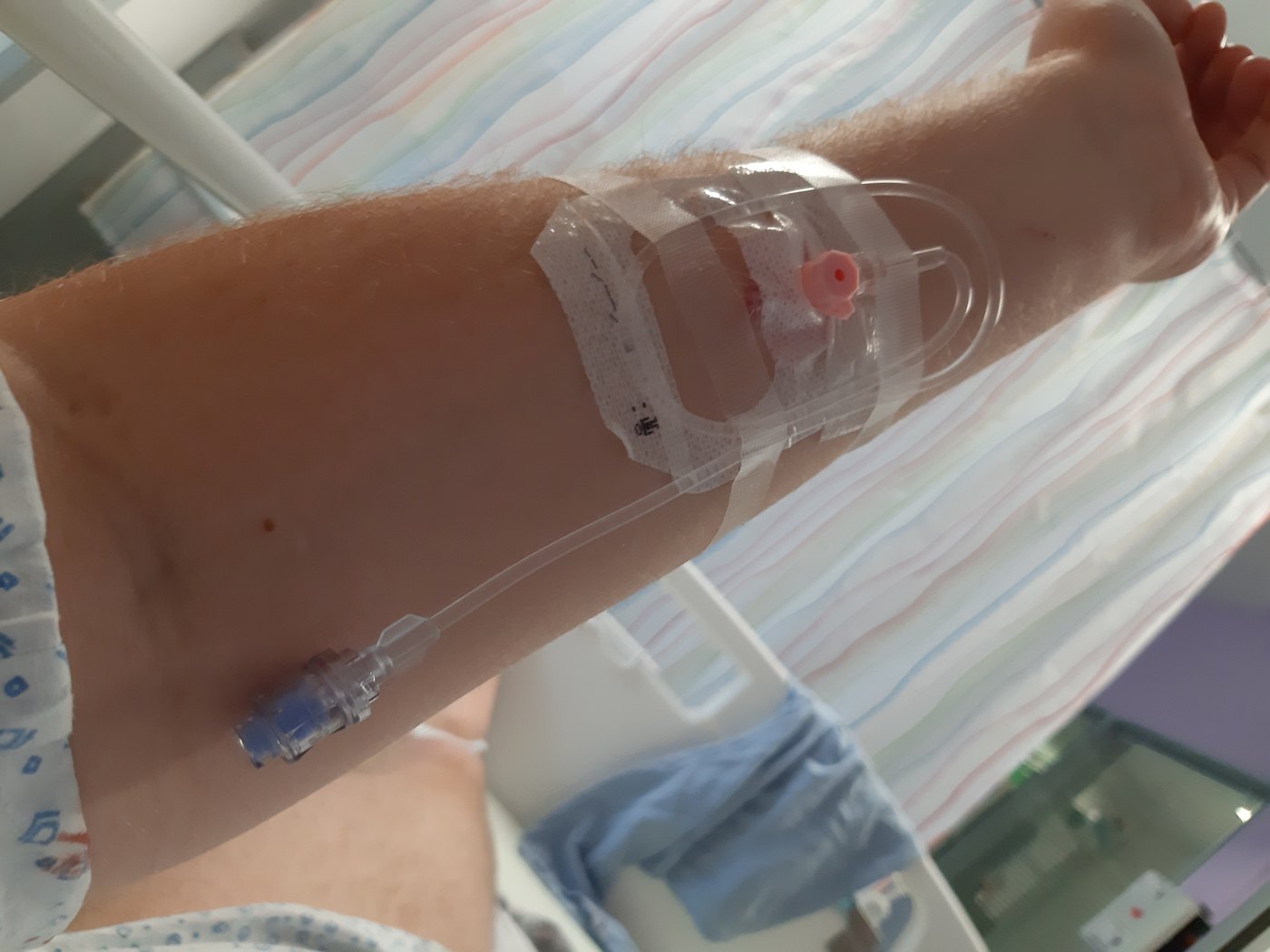 A pink intravenous cannula secured with tape on the forearm of a patient lying in a hospital bed, connected to a thin infusion tube
